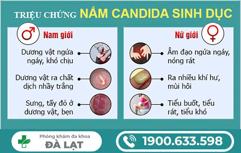 Hình ảnh minh họa